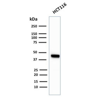 Cytokeratin 18 Antibody