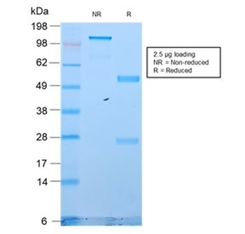 Cytokeratin 18 Antibody