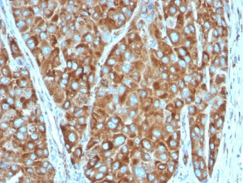 RPSA Antibody / 40S Ribosomal protein SA