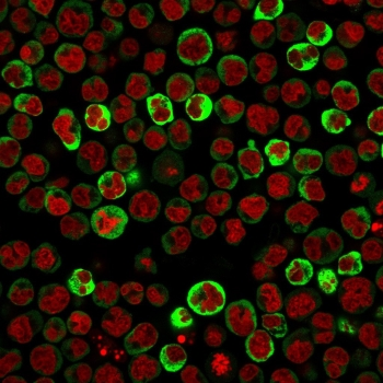 RPSA Antibody / 40S Ribosomal protein SA