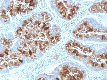 MUC1 Antibody / Mucin-1