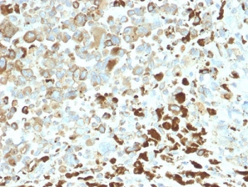 NGF Receptor Antibody / p75NTR / CD271