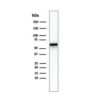 NGF Receptor Antibody / p75NTR / CD271