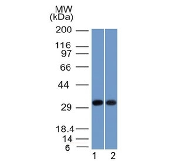 Nucleophosmin Antibody / NPM1