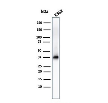 Nucleophosmin Antibody / NPM1