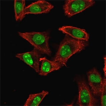 Nucleophosmin Antibody / NPM1