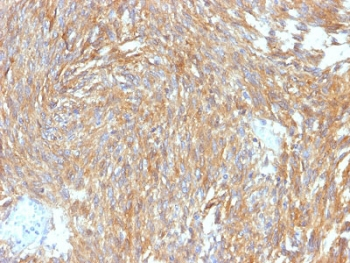 DOG1 Antibody / TMEM16A / ANO1