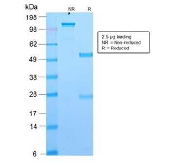 DOG1 Antibody / TMEM16A / ANO1