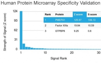 TMEPAI Antibody / PMEPA1