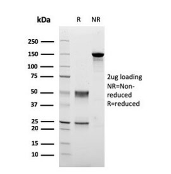 TMEPAI Antibody / PMEPA1