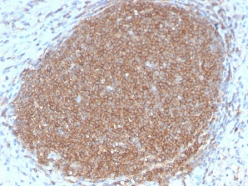 CD45RB Antibody (B-cell marker)