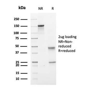 TMEPAI Antibody / PMEPA1