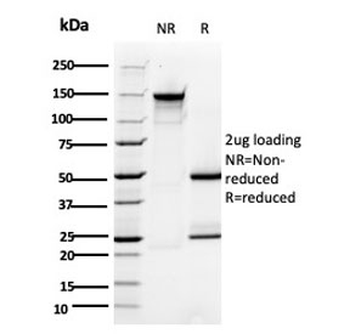 TMEPAI Antibody / PMEPA1