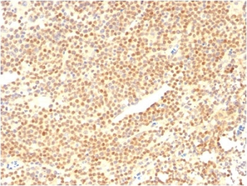 Cyclin D1 Antibody / CCND1