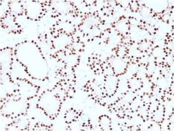 Cyclin D1 Antibody / CCND1