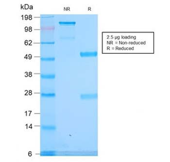 SPTA1 Antibody / Spectrin alpha 1