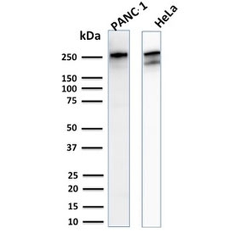 SPTBN2 Antibody / Spectrin beta III