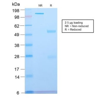 SPTBN2 Antibody / Spectrin beta III