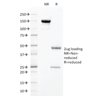 HNF1A Antibody