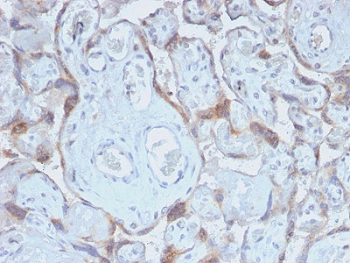 Recombinant TIMP2 Antibody
