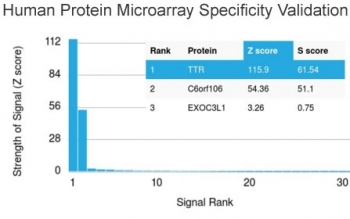 Prealbumin Antibody / Transthyretin / TTR