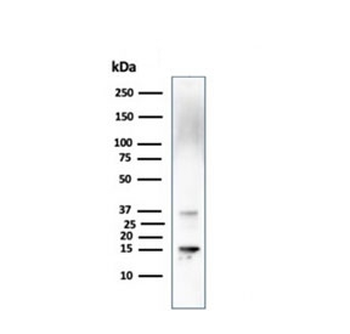 Prealbumin Antibody / Transthyretin / TTR