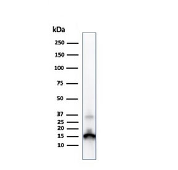 Prealbumin Antibody / Transthyretin / TTR
