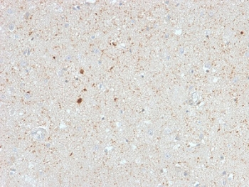 Calbindin 2 Antibody / CALB2 / Calretinin