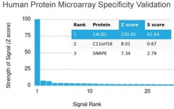 Calbindin 2 Antibody / CALB2 / Calretinin