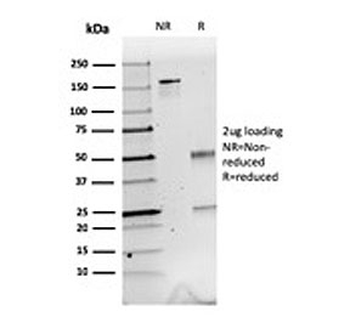 Calbindin 2 Antibody / CALB2 / Calretinin