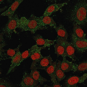 VTCN1 Antibody / B7H4