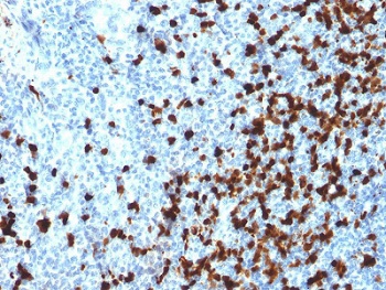 TCL1 Antibody