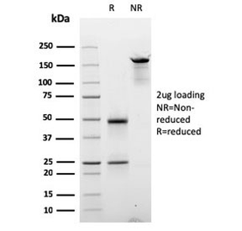 Cyclin D2 Antibody / CCND2