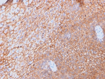CD40L Antibody / TRAP / CD154