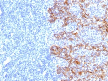 Acidic Cytokeratin Antibody (LMW / Type I)