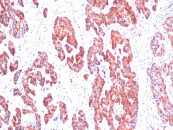 Basic Cytokeratin Antibody (HMW / Type II)