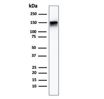 EGF Receptor / EGFR Antibody