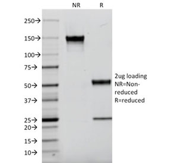 EGF Receptor / EGFR Antibody