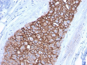 HER2 Antibody / ErbB2