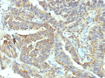 ALPL Antibody / Alkaline Phosphatase (tissue-nonspecific)