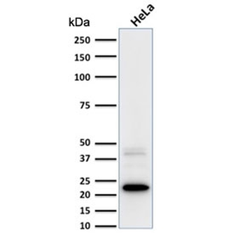 FTL Antibody / Ferritin light chain