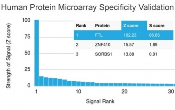 FTL Antibody / Ferritin light chain