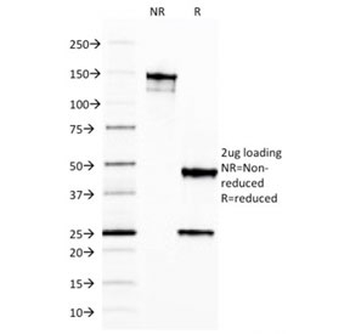 FTL Antibody / Ferritin light chain