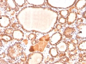 GLO1 Antibody / Glyoxalase I