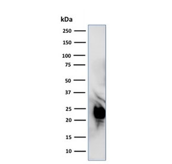 GLO1 Antibody / Glyoxalase I
