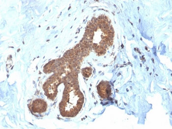 GSTM2 Antibody / Glutathione S-Transferase mu 2
