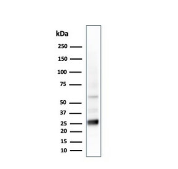 GSTM2 Antibody / Glutathione S-Transferase mu 2