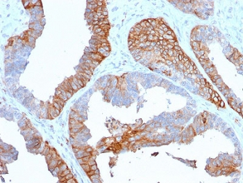 HLA-DR Antibody (MHC II)