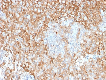 HLA-DR Antibody (MHC II)