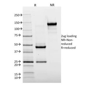 HLA-DR Antibody (MHC II)